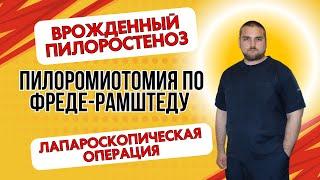 Лапароскопическая пилоромиотомия по Фреде-Рамштедту | Laparoscopic Pyloromyotomy | Хирург Предко С.Н