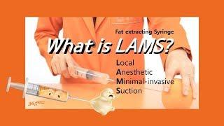 [ENG Sub] What is fat extracting syringe LAMS ? 365mc seoul liposuction hospital answers!