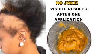 Using this treatment for hair growth will be one of the best decisions of your life! April 21, 2024