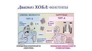 Современные аспекты диагностики и лечения ХОБЛ