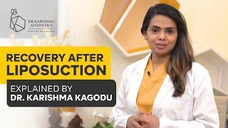 The #liposuction  recovery journey explained by Dr. Karishma Kagodu | #bengaluru  | India