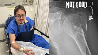 I Shattered My Shoulder... Now What?