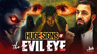 SIGNS THAT YOU HAVE BEEN GIVEN THE EVIL EYE | Belal Assaad