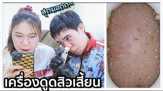 รีวิว เครื่องดูดสิวเสี้ยน ติดกล้อง Xiaomi เกือบทำเสียโฉม?? 