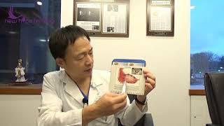 New Hope Fertility Dr Zhang: What is AMH?