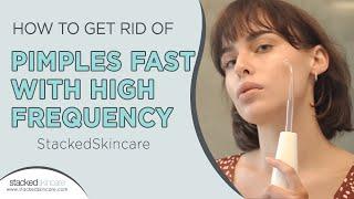 How To Get Rid Of Pimples Fast With High Frequency - StackedSkincare