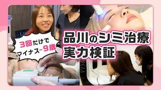 【 YouTuberのべちゃん 】フォトシルクプラス で 肌年齢 は何歳若返る？【 シミ治療 】