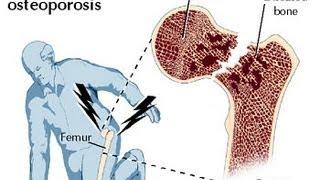 How to build better bone density