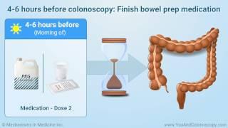 What is a colonoscopy and how do I prepare for it?