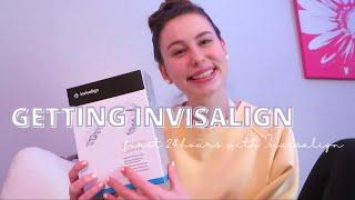 GETTING INVISALIGN: first 24 hours with invisalign