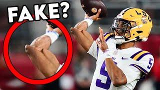 Jayden Daniels Deformed Elbow is Worrying NFL Fans - Doctor Reacts