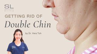 How to Get Rid of a Double Chin #doctor #aesthetic #clinic #doublechin #laser #liposuctionsurgery