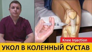 Внутрисуставные инъекции в коленный сустав | Knee Injection