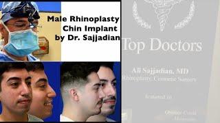 Male Rhinoplasty & Chin Implant by Dr. Ali Sajjadian | Plastic Surgery