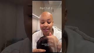 How to install a wig with alopecia part 1 of 2