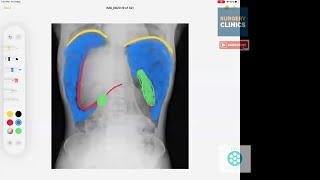 CCC Radiology - Abdominal Xray Essentials for the Surgical Trainee by Ramanuj Mukherjee