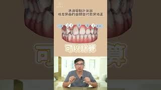 牙齒亂可以不拔牙矯正嗎？透過隱適美矯正，不拔牙也可以達到理想效果！隱適美矯正案例分享｜【祐民牙醫－隱適美旗艦店】鑽石級楊大為醫師 #隱適美 #隱形牙套 #隱形矯正 #牙齒矯正