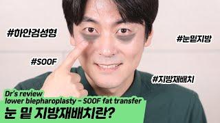 [눈밑지방재배치]? 성형외과 전문의가 알려줄게