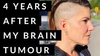 4 years After My Brain Tumour