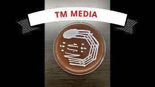 MY EXPERIENCE OF "READY TO USE MEDIA" FROM TM MEDIA