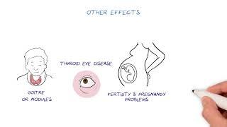 Thyroid Disease HealthSketch