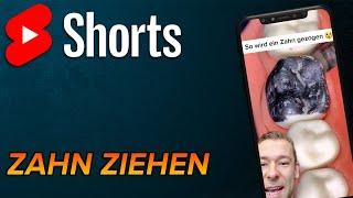 Zahn ziehen! #shorts