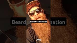 From Brittle Beard to Braw Beard #beards #beardgrowth #beardlife