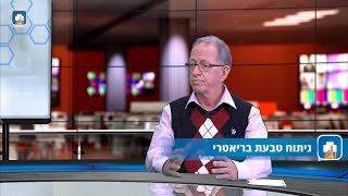 ניתוח טבעת לקיצור קיבה - ד"ר אליעזר אבינח