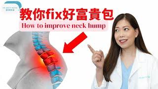 教你 FIX 好富貴包 -脊醫王鳳恩 - (中/Eng Sub) - How to improve neck hump - Dr Matty Wong Doctor of Chiropractic