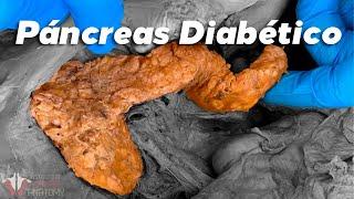 Los Efectos de la Diabetes en tu Cuerpo  ¿Puede curarse?