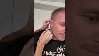 Draining My Cauliflower Ear