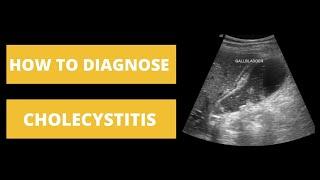 How to Diagnose Cholecystitis - Imaging Basics