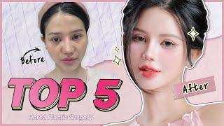 TOP5 Amazing Transformations/before and after | NANA HOSPITAL KOREA