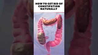 Get rid of constipation | treatment of constipation #viral