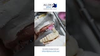 How we make our teeth in 24 hours!  #dentist #allon4dentalimplants