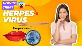 how to treat herpes virus symptoms? hsv1 और hsv2 के लक्षणों से कैसे राहत पाए? हरपीस का इलाज?#hsv1