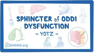 Sphincter of Oddi dysfunction (Year of the Zebra 2024)