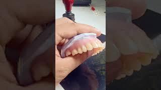 Full denture bioton Thermo plastic