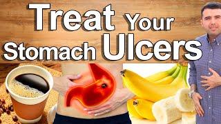 Do This And Cure Your Stomach Pain, Gastritis and Ulcers - Best Natural Treatment of Stomach Pain