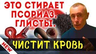 ЭТО СТИРАЕТ ПСОРИАЗ, ГЛИСТЫ, ОЧИЩАЕТ КРОВЬ! Обзор на масло черного тмина. Как очистить кровь.