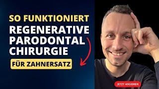 Regenerative Parodontologie  | Zahnarzt Dr. Maximilian Fuhrmann