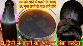 रूखे सूखे बेजान बालों में भी डाल देगा एक नई जान - 100% नए बाल उगाएँ | DIY Powerful Hair Growth Serum