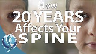 How 20 Years Affects Your Spine