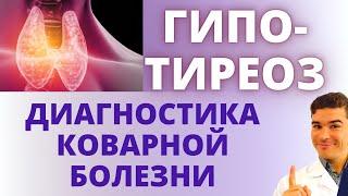 Гипотиреоз: подавленная щитовидная железа, дефицит щитовидных гормонов. Диагностика щитовидки дома.