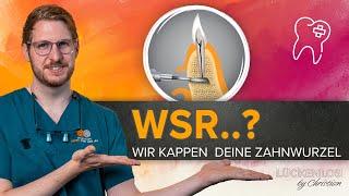 Wurzelspitzenresektion – Was genau erwartet mich?