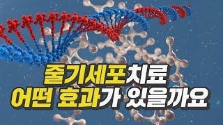 줄기세포치료 어떤 효과가 있을까요? 합법적인 줄기세포치료 #줄기세포치료