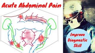 Assessing acute abdominal pain | A novel algorithm