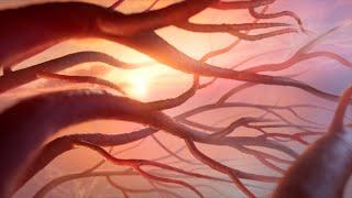 Sickle Cell Disease | MOA Animation
