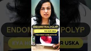 What is an Endometrial Polyp & how's it treated? | Endometrial Polyp in Hindi | Dr. Nymphea Walecha