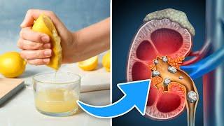 Durchbruch: So kann Zitronensaft vor Nierensteinen schützen!